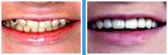 Dentist Temecula - Home Gallery Image 01
