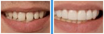 Dentist Temecula - Home Gallery Image 02