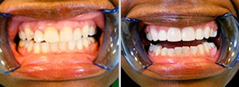 Before, After Image 01, Cincinnati