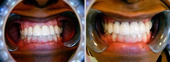 Before, After Image 03, Cincinnati