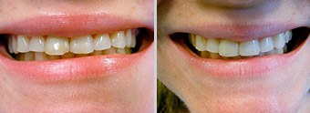 Before, After Image 06, Cincinnati
