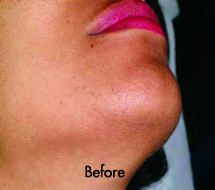 Skin Care Birmingham - Laser Hair Removal 12