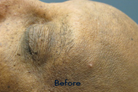 Skin Care Birmingham - VI Peel  01