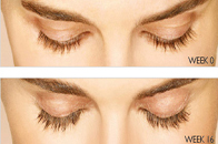 Skin Care Birmingham - Latisse  03