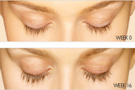 Skin Care Birmingham - Latisse  05