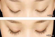 Skin Care Birmingham - Latisse  07