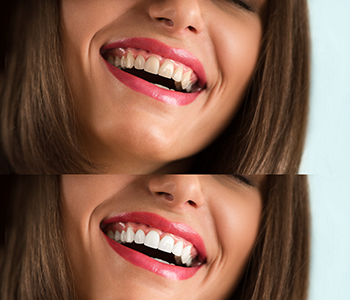 Phoenix dentist explains cosmetic dentistry