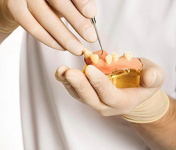 Dental Bridges