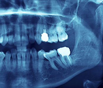 Restorative Dentistry