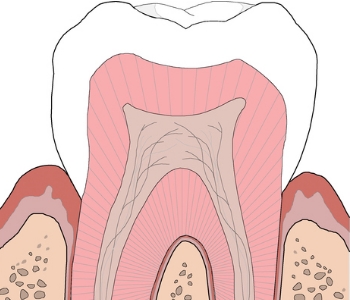 Glendale patients seek root canal therapy to save their teeth