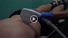 Injectables Video 1