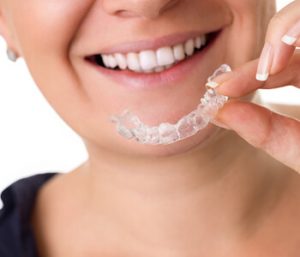 Invisalign