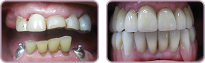<?=$pk;?> - Before After Case 01