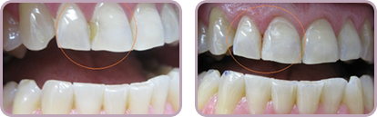 <?=$pk;?> - Before After Case 02