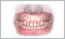 Denture Dentist Sutton